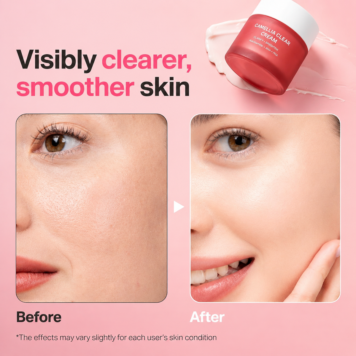 Gentle Resurfacing Barrier Cream